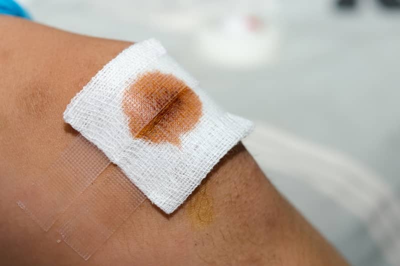 hemostatic dressing